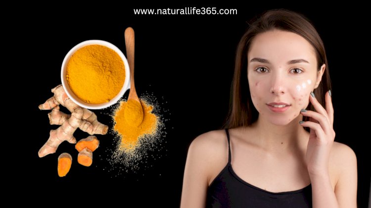Say Goodbye to Acne and Dark Spots with Turmeric